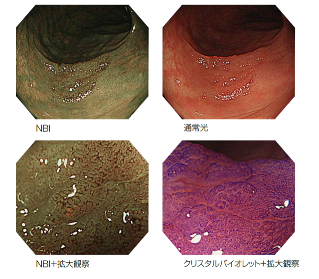 最新の大腸カメラを導入しました